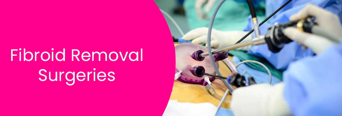 Fibroid Removal Surgeries at Laimaa Fertility, Delhi