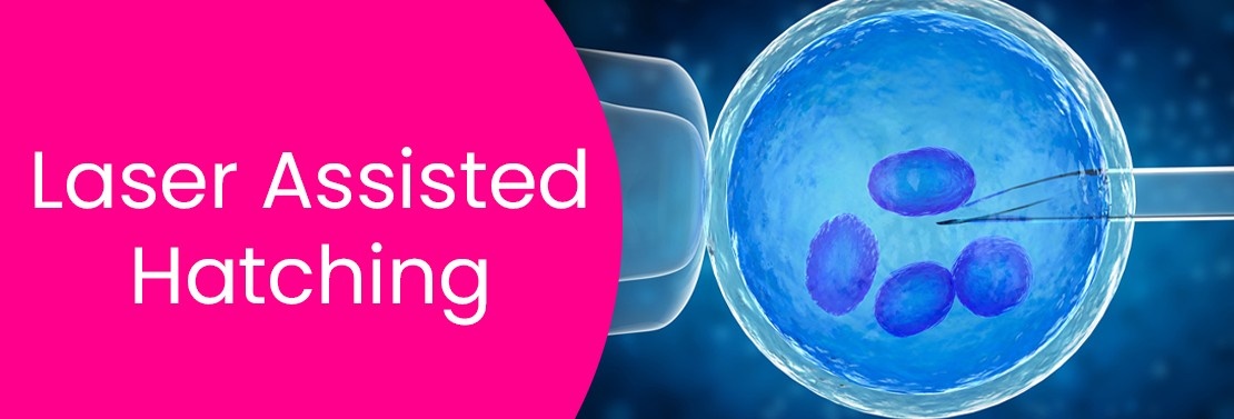 Laser-Assisted Hatching (LAH) at Laimaa Fertility, Delhi