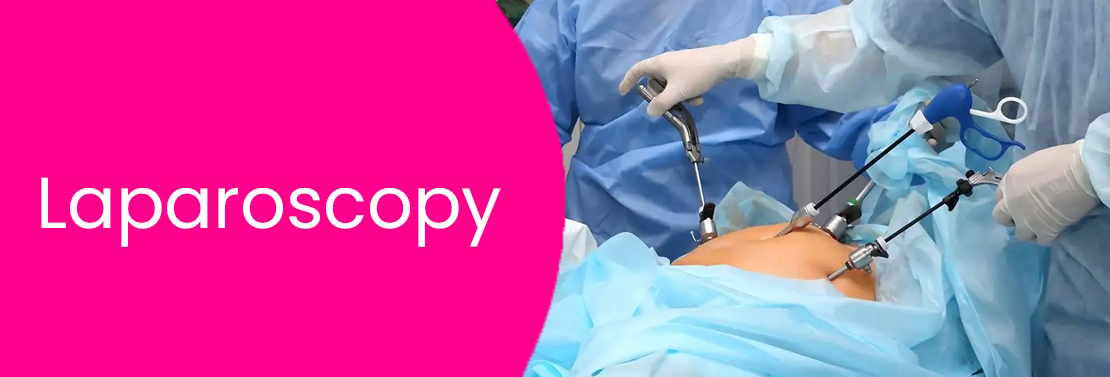 Diagnostic / Operative Laparoscopy at Laimaa Fertility, Delhi
